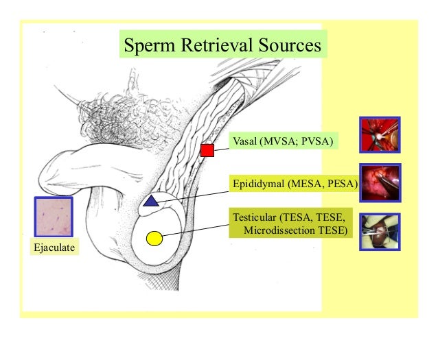 Stimulate a womans anus pleasurable Ass in sperm